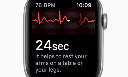 Apple Watch Ekg Detail
