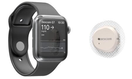 Dexcom G7 Und Apple Watch